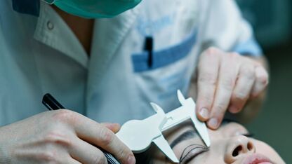 De psychologische voordelen van een ooglidcorrectie