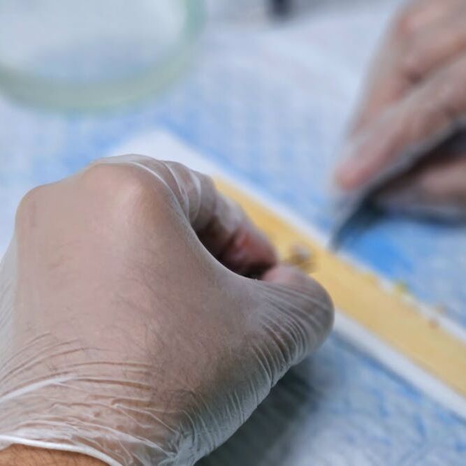 De weg naar natuurlijk uitziend haar met FUE transplantatie